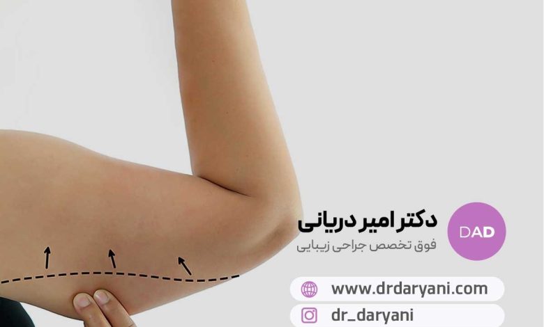 بازوهایی خوش‌فرم و جوان با جراحی لیفت بازو